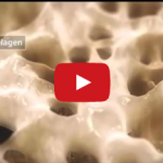 Principi di riparazione ossea: guarigione primaria e secondaria DM_il dentista moderno_riparazione-ossea-guarigione