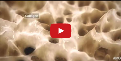 DM_il dentista moderno_riparazione-ossea-guarigione