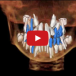 La documentazione per un’adeguata pianificazione ortodontica DM_Il dentista moderno_pianificazione ortodontica