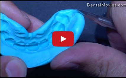 DM_il dentista moderno_ceratura indice in silicone mock up diagnosi estetica