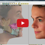 Il piano di trattamento in chirurgia ortognatica DM_il dentista moderno_il piano di trattamento in chirurgia ortognatica