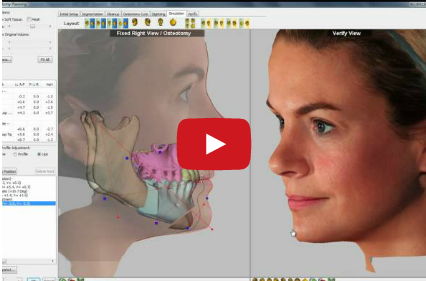 DM_il dentista moderno_il piano di trattamento in chirurgia ortognatica