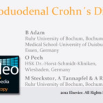 Morbo di Crohn e odontoiatria DM_il dentista moderno_morbo di Chron_odontoiatria