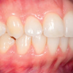 Dipende tutto dai punti di vista