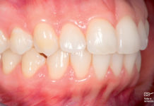 Dipende tutto dai punti di vista