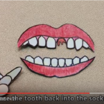 Comunicare con i nostri pazienti: La prevenzione dei traumi dentari in ambiente domestico DM_il dentista moderno_prevenzione dei traumi dentari