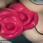 La registrazione dell’occlusione in odontoiatria DM_il dentista moderno_registrazione occlusale