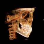 Aspetti tecnici della CBCT in odontoiatria dm_il-dentista-moderno_cbct-in-ortodonzia