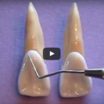 Anatomia: incisivi e canini mascellari e mandibolari dm_il-dentista-moderno_anatomia-incisivi-e-canini