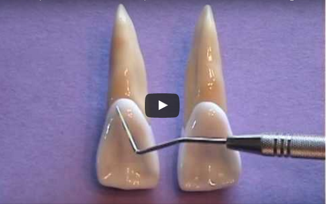 dm_il-dentista-moderno_anatomia-incisivi-e-canini