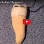 Anatomia: premolari mascellari e mandibolari dm_il-dentista-moderno_anatomia-premolari-mascellari-e-mandibolari