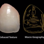 Scelta del colore in restaurativa conservativa DM_il dentista moderno_scelta del colore_restaurativa conservativa odontoiatria