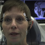 Valutazione attività dei muscoli masticatori: EMG e nuove prospettive dm_il-dentista-moderno_valutazione-muscoli-masticatori