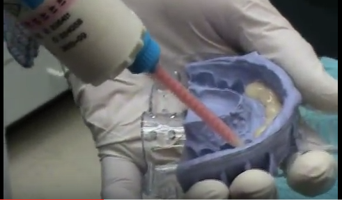 dm_il-dentista-moderno_shrink-wrap-provvisorizzazione-faccette-estetiche