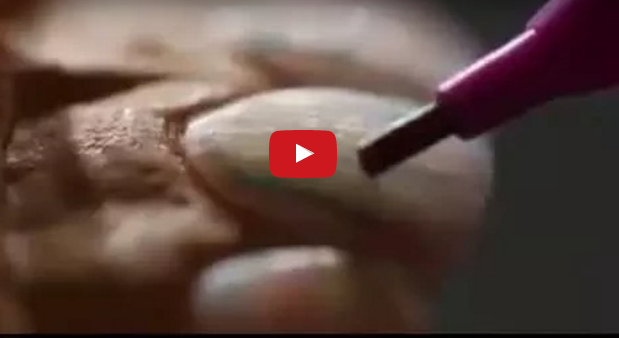 dm_il-dentista-moderno_trasformare-la-ceratura-diagnostica-in-mock-up-ed-infine-in-provvisorio