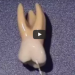 Anatomia molari superiori dm_il-dentista-moderno_anatomia-molari-superiori_primo-molare-superiore_secondo-molare-superiore_terzo-molare-superiore