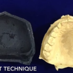 Sviluppare i modelli in gesso dall’impronta in alginato dm_il-dentista-moderno_sviluppare-limpronta-in-gesso-dallimpronta-in-alginato