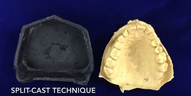 dm_il-dentista-moderno_sviluppare-limpronta-in-gesso-dallimpronta-in-alginato