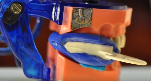 dm_il-dentista-moderno_triple-tray_impronta-di-precisione