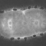 Rigenerativa endodontica: attualità clinica, tassi di successo e strumenti per realizzarla