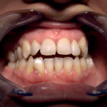 Suoni linguistici e strutture anatomiche del cavo orale