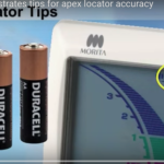 Trucchi per l’utilizzo del localizzatore apicale e possibili fonti di errori dm_il-dentista-moderno_rilevatore-apicale