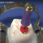 L’evoluzione dei rilevatori apicali in endodonzia dm_il-dentista-moderno_rilevatori-apicali-endodonzia
