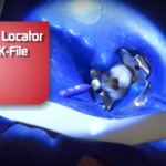 Endodonzia: le origini del rilevatore apicale dm_il-dentista-modenro_endodonzia_rilevatore-apicale