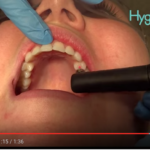 Strumenti per la diagnosi di carie: Diagnodent VS convenzionali dm_il-dentista-moderno_diagnodent-carie-lesione-cariosa-diagnosi