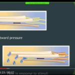 Ipersensibilità dentinale: meccanismi e teorie dm_il-dentista-moderno_ipersensibilita-dentinale-meccanismi-teorie