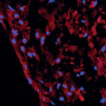 Cellule staminali della polpa dentale