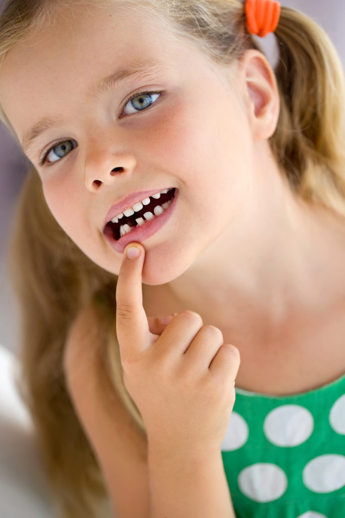 traumi dei decidui Lo splintaggio nel paziente che ha subito trauma dentario traumatologia dentale denti decidui