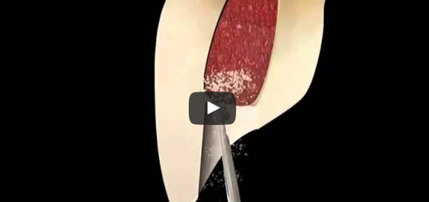 dm_il-dentista-moderno_anatomia-canalare-incisivo-centrale-laterale-e-canino-mascellaridm_il-dentista-moderno_anatomia-canalare-incisivo-centrale-laterale-e-canino-mascellari