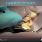 Odontoiatria pediatrica:l’evoluzione nel trattamento della dentizione decidua dm_il-dentista-moderno_odontoiatria-pediatrica-levoluzione-nel-trattamento-della-dentizione-decidua