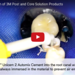 Cementazione perni in fibra con adesivi multimode DM_il dentista moderno_cementazione perno in fibra_adesivo universale_adesivo multimode