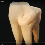 Manifestazioni dell’invecchiamento a livello dentale DM_il dentista moderno_invecchiamento dentale_smalto polpa dentina