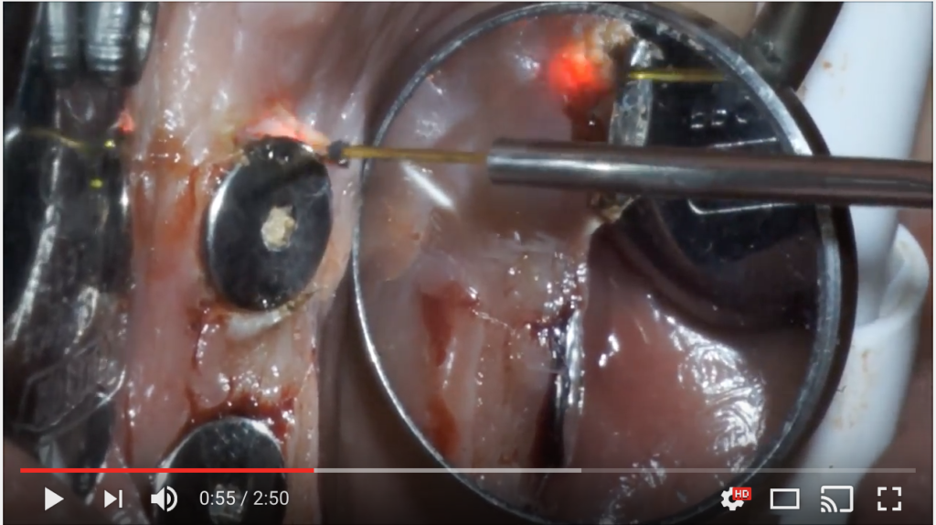 DM_il dentista moderno_laser_parodontologia_implantologia