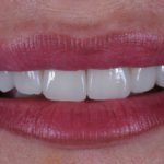 Webinar gratuito: semplificazioni in tema di materiali compositi