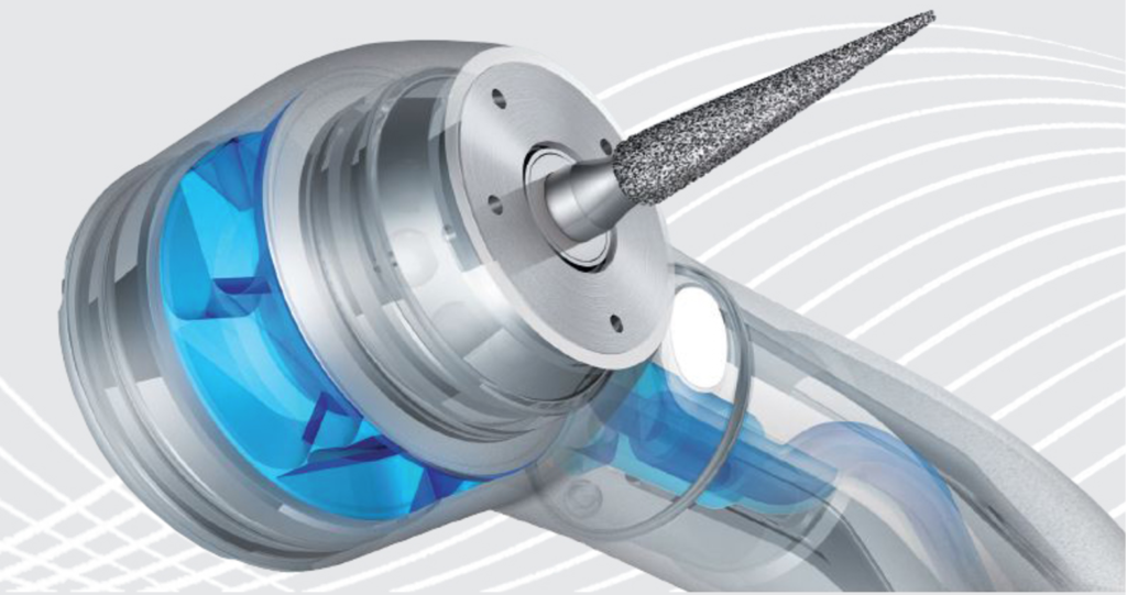 DM_il dentista moderno_ La scelta della turbina e del contrangolo nell’odontoiatria contemporanea