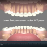 Agenesie dentarie: eziologia ed epidemiologia DM_il dentista moderno_agenesie dentarie_schema di eruzione_eruzione denti permanenti eruzione denti decidui