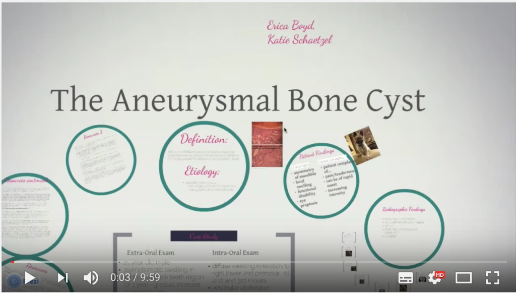 Dm_il dentista moderno_cisti aneurismatica dei mascellari_chirugia_