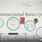 Cisti aneurismatica dei mascellari: eziologia ed epidemiologia Dm_il dentista moderno_cisti aneurismatica dei mascellari_chirugia_