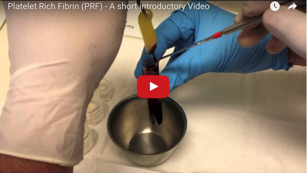 DM_il dentista moderno_prp