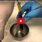 PRP: processi produttivi DM_il dentista moderno_prp