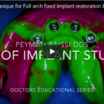 Tecniche di rilevazione dell’impronta in implantologia: un approccio evidence-based DM_il dentista modernoTecniche di rilevazione dell'impronta in implantologia un approccio evidence-based