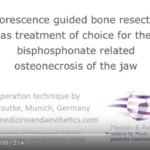 Trattamento chirurgico osteonecrosi da bifosfonati DM_il dentista moderno_Trattamento chirurgico osteonecrosi da bifosfonati