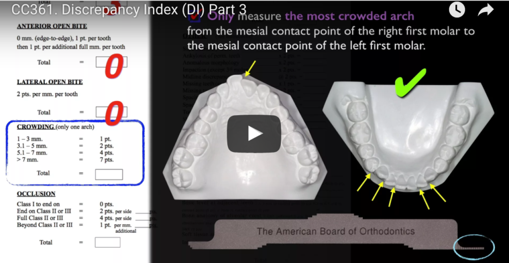 DM_il dentista moderno_analisi di Bolton