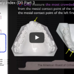 Analisi di Bolton: la “proporzione aurea” dell’ortodonzia DM_il dentista moderno_analisi di Bolton