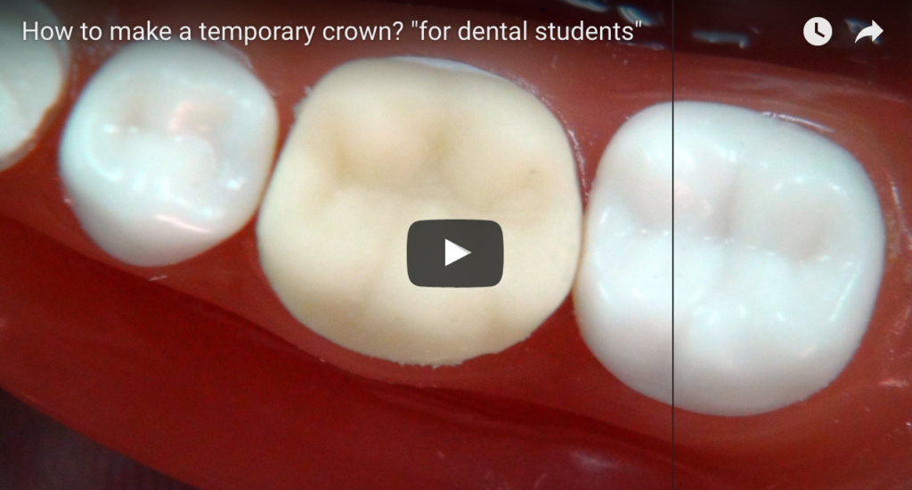 DM_IL DENTISTA MODERNO_Realizzare un provvisorio dalle migliori caratteristiche e nel minor tempo