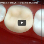 Realizzare un provvisorio dalle migliori caratteristiche e nel minor tempo DM_IL DENTISTA MODERNO_Realizzare un provvisorio dalle migliori caratteristiche e nel minor tempo